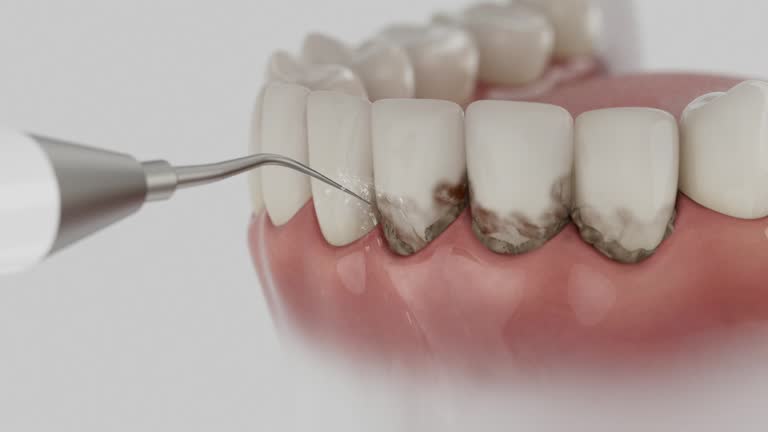 Reliable Dental Implants contractor in Sutter Creek, CA by Smile Center Dentistry